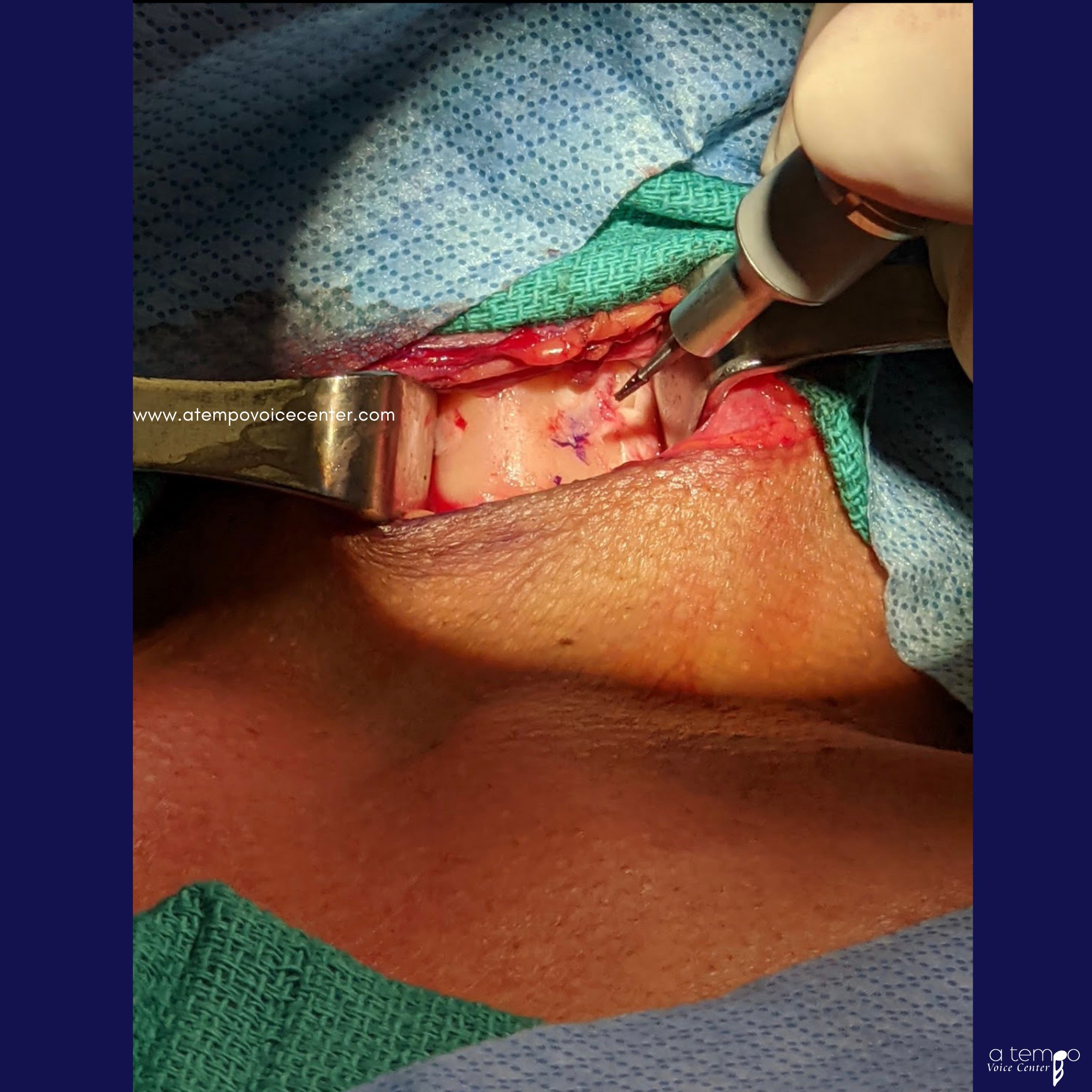 A mark was made for the drill location